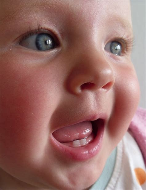File:Baby teeth in human infant.jpg - Wikimedia Commons
