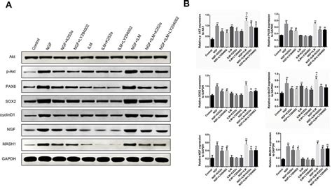 Western Blot results for cells in each group. (A) Each group ...