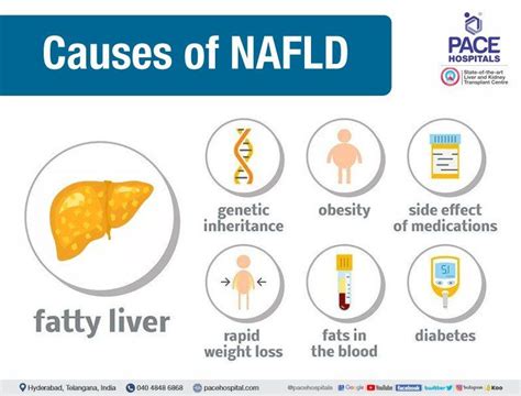 NAFLD & NASH - Symptoms, Causes, Differences & Treatment Options