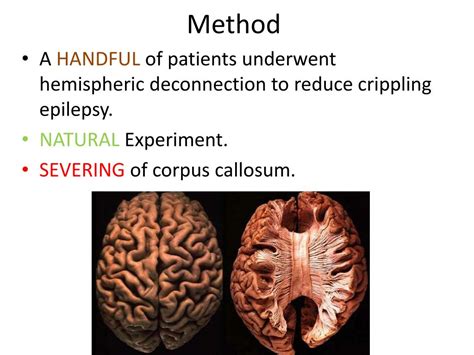 PPT - The split Brain PowerPoint Presentation, free download - ID:2591366