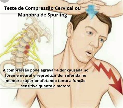 Você sabe o que é Teste de Spurling? - ITC Vertebral