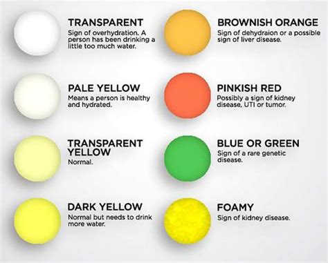 5 causes of dark urine - awesomequotes4ucom meaning behind color of your urine | urine color ...