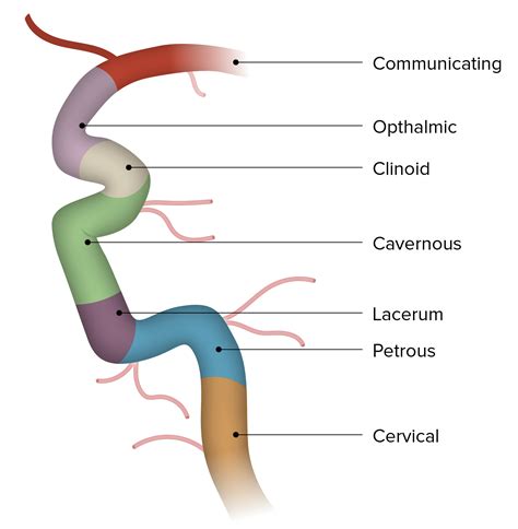 Carotid Arterial System: Anatomy | Concise Medical Knowledge