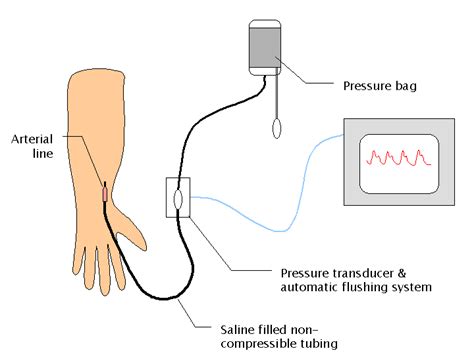 Haemodynamic monitoring | Arterial line, Icu nursing, Arterial pressure