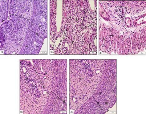 Myometrium Histology