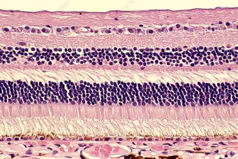 Histology of normal retina - Stock Image P424/0213 - Science Photo Library