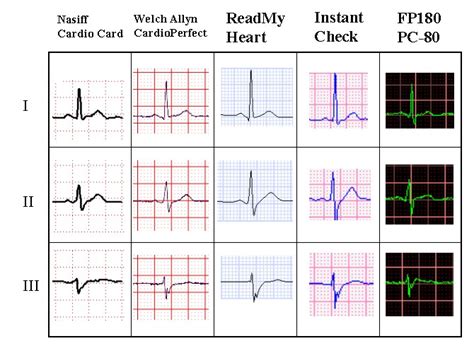 1-lead to 12-lead and exercise ECG