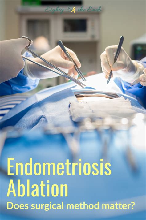 Endometriosis Ablation | Does surgical method matter?