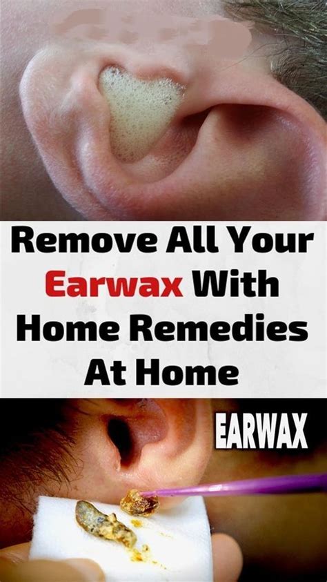 Remove All Your Earwax With Home Remedies At Home | Clean ear wax out ...