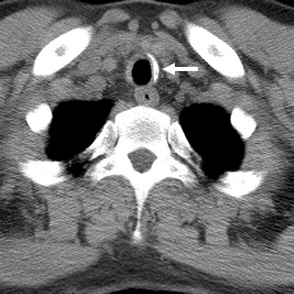 (A) The patient's ear showed pinna deformity with cauliflower... | Download Scientific Diagram