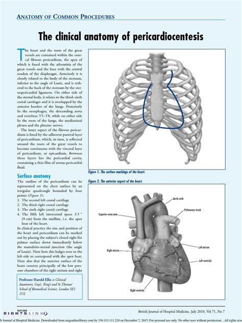 The Clinical Anatomy of Pericardiocentesis: Natomy of Ommon Rocedures | Download Free PDF ...