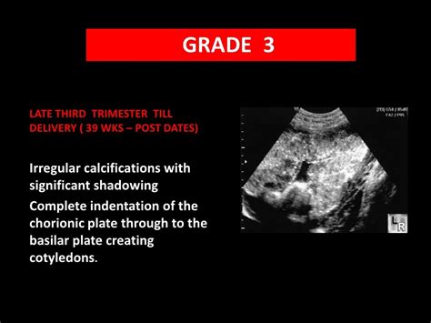 Placental grading