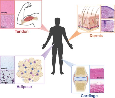 Anatomy and disease state affect connective tissue structure–function... | Download Scientific ...