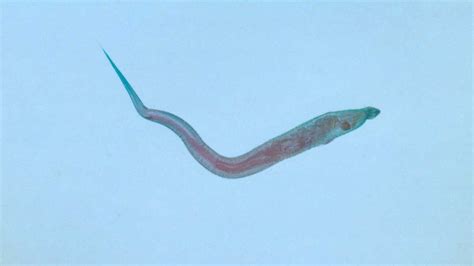 Pinworms: Infection, Causes, Symptoms, Treatment, Prevention