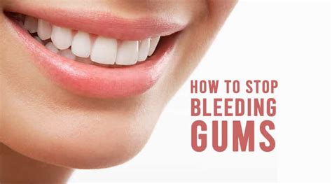 How to Stop Bleeding Gums and Maintain Oral Health | HealthtoStyle