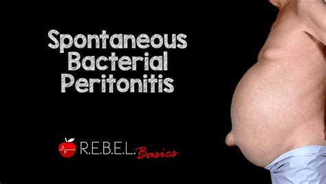 Spontaneous Bacterial Peritonitis - REBEL EM - Emergency Medicine Blog