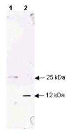 Anti Human TGF Beta Antibody | Bio-Rad