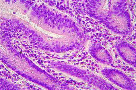 H&E Staining in Microscopy | Science Lab | Leica Microsystems