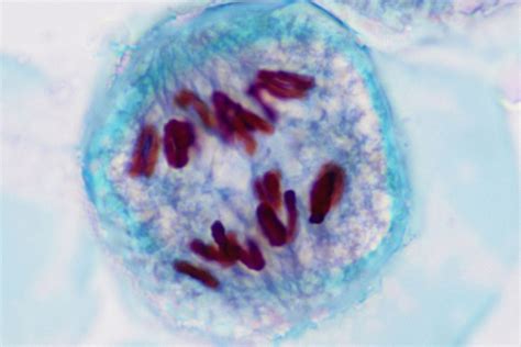 Overview of the Stages of Meiosis