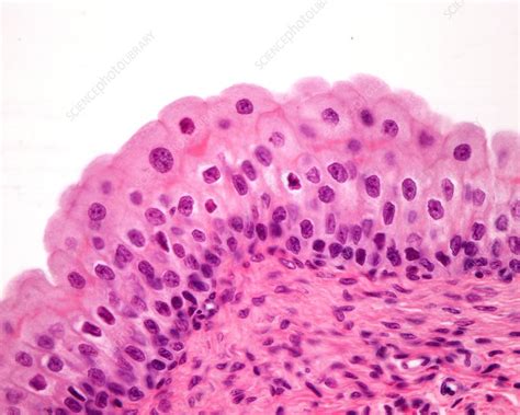 Transitional Epithelium