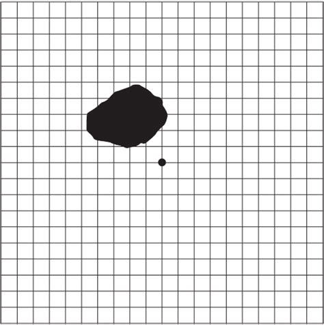 Example of results of threshold Amsler grid testing on a patient... | Download Scientific Diagram