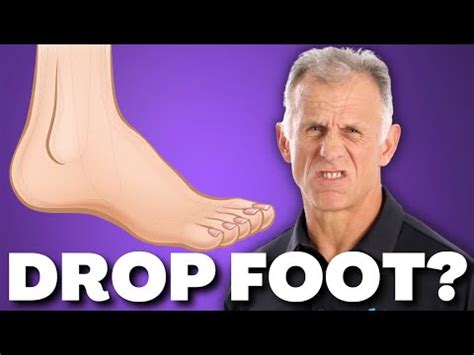 Foot Drop Exercises | TBI Rehabilitation