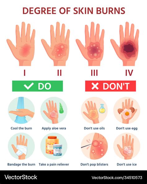 Burns degree first aid for burn wound fire Vector Image