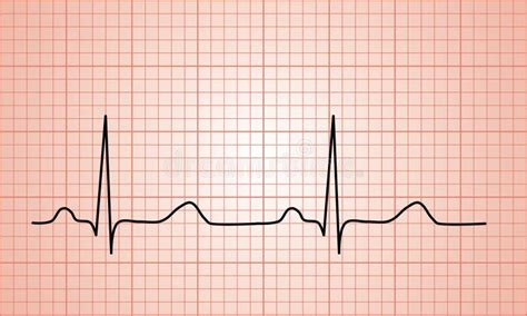 Heartbeat Normal ECG graph stock illustration. Illustration of muscular ...