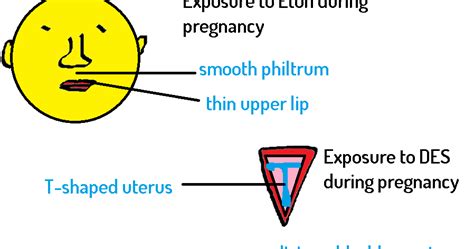 Doctors Network: Teratogenic drugs and their effects