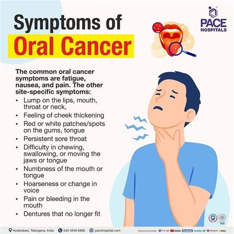 Mouth Cancer Symptoms: Recognizing the Signs of Oral Cancer | by PACE ...