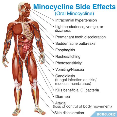 The Side Effects of Antibiotics - Acne.org