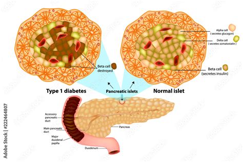 The pancreas has many islets that contain insulin-producing beta cells and glucagon-producing ...