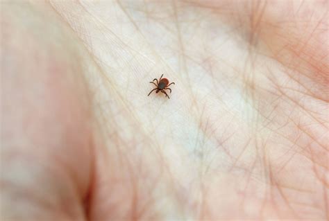 Don't Panic If You Get Bit By A Tick. Here Are 5 Tips To Minimize Lyme ...