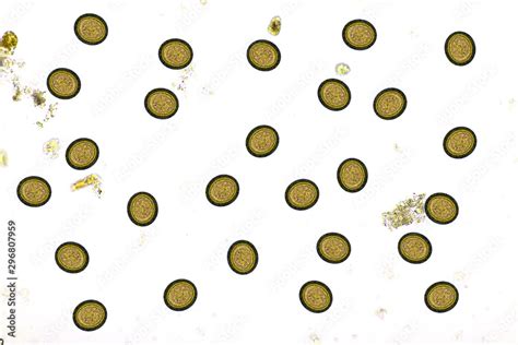Tapeworm Under A Microscope