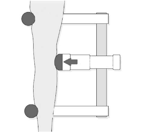 Schematic valgus stress test performed on the knee with the Telos ...