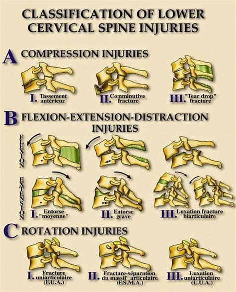 Thoracic and Cervical Spine Injury | RadTechOnDuty | Cervical, Thoracic ...