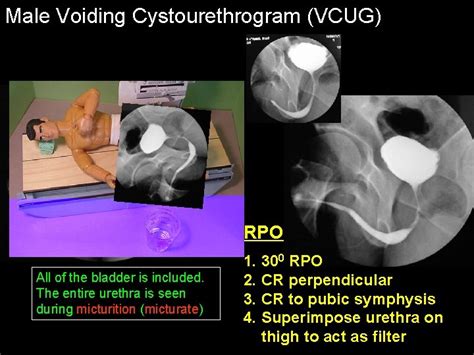 Unit 7 Cystography Retrograde Urography RDSC 233 Bontrager