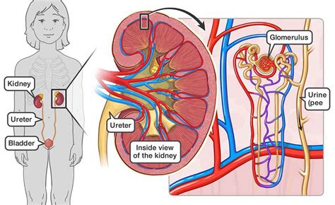 Post streptococcal glomerulonephritis causes, symptoms, diagnosis, treatment & prognosis