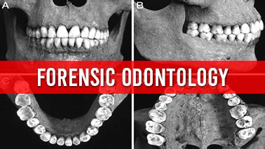 Forensic Odontology Conferences | Europe | Asia | Middle East | Canada ...