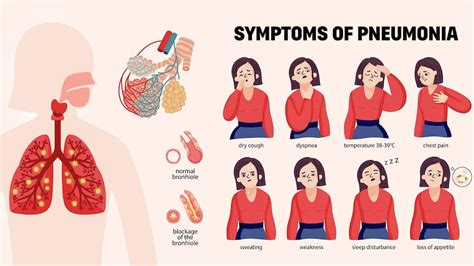 What Causes Pneumonia and How Serious Is It? | OnlyMyHealth