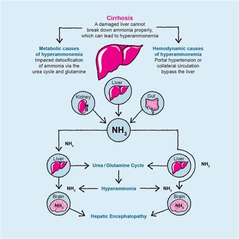 Liver Disease Hepatic Encephalopathy Fatty Liver Hepatitis Png | Images and Photos finder