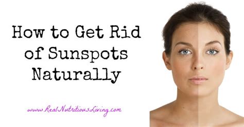 How to Get Rid of Sunspots Naturally | Real Nutritious Living