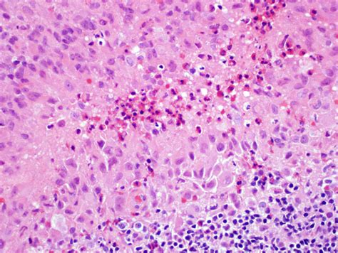 Langerhans Cells Histology