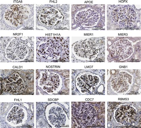 Single-cell RNA-sequence analysis of mouse glomerular mesangial cells uncovers mesangial cell ...