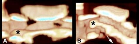 Atlantoaxial instability - Canada West Veterinary Specialists