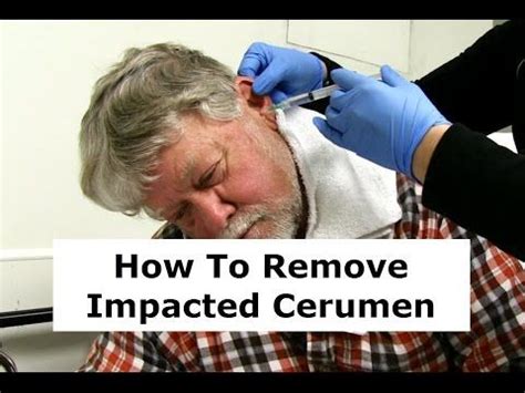 Removing Impacted Cerumen from a Patient's Ear | Ear wax removal, Impacted ear wax removal, Ear ...