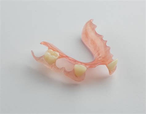 Flexible Partial Dentures at Best Price- Dental Lab Direct