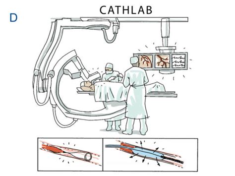 Cath Lab Picture – Cardiovascular Interventions Orlando