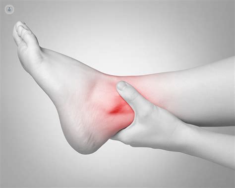 Ankle arthritis: what is subtalar arthritis