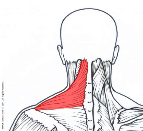 Fig 1 Upper trapeziussm | Posturedontics